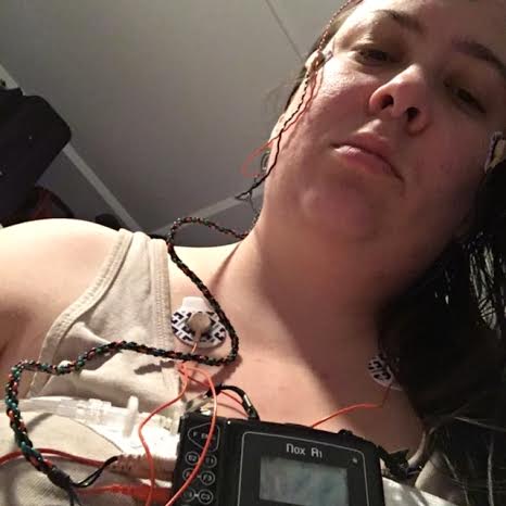 Strapped in to the home sleep study kit and unhappy